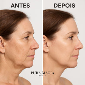 Booster Facial Radiance – Tecnologia RF, EMS, LED e Ultrassom em um só aparelho