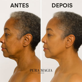 Booster Facial Radiance – Tecnologia RF, EMS, LED e Ultrassom em um só aparelho
