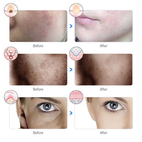 Máscara Facial LED 7 Cores para rejuvenescimento, tratamento antiacne e antirrugas.